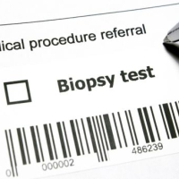 Understanding the Skin Biopsy: What to Expect and What It Means for You
