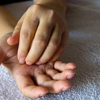 Understanding the Different Types of Eczema