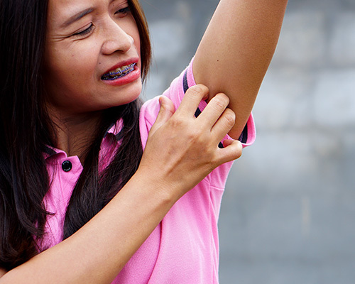 Little girl itching a spot affected by Hidradenitis Suppurativa 