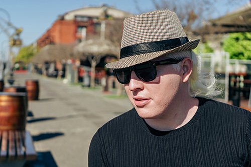 Man with albinism out in the sun wearing a hat and sunglasses